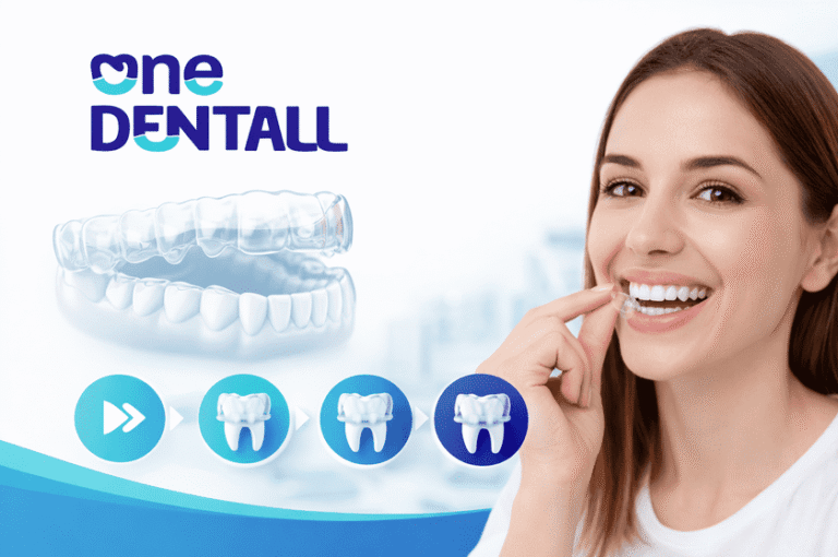 Aligners optimized 200 resized 768x510
